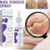 Nail Fungus Spray