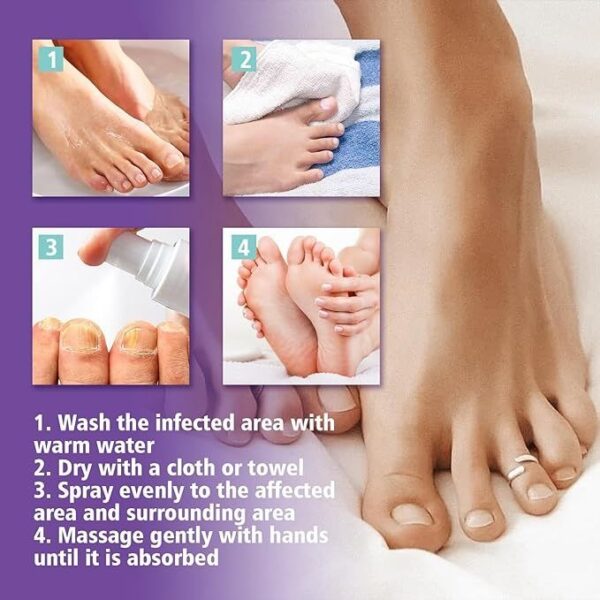 Nail Fungus Spray - Image 4