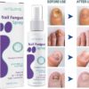 Nail Fungus Spray - Image 2