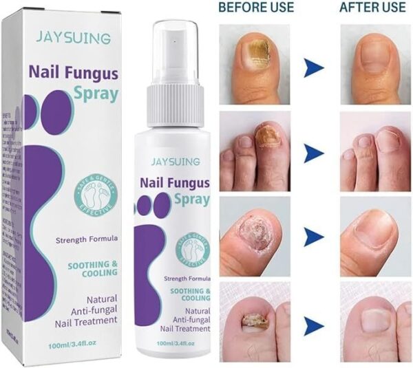 Nail Fungus Spray - Image 2